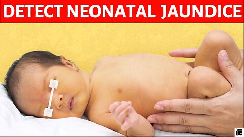 Is Your Baby Turning Yellow? Detecting Neonatal Jaundice Early!