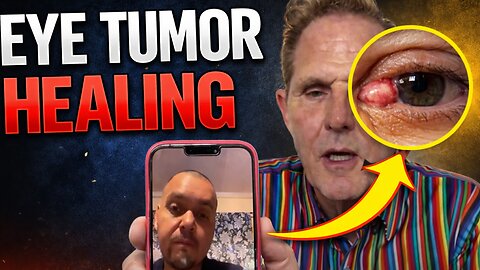 EYE TUMOR 👁️ REAL PEOPLE REAL HEALING ❤️‍🩹