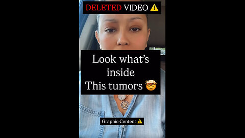 DELETED VIDEO 😡 Look what's inside This tumors ⚠️ Graphic Content