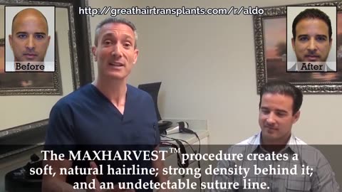 Dr. Brett Bolton – Celebrity Hair Transplant Clinic Compilation (Video 1) - promo