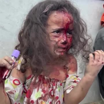 A wounded Gazan child weeps as she holds a blood sample tube in her tiny injured hand