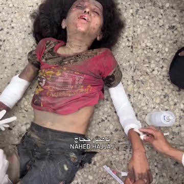 Injuries, including children, arrived at Al-Shifa Medical Complex