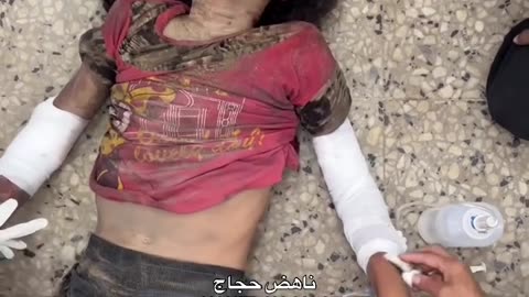 Injuries, including children, arrived at Al-Shifa Medical Complex