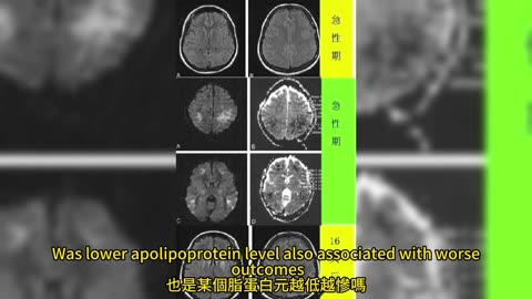 血液關鍵因子 「脂蛋白元M」