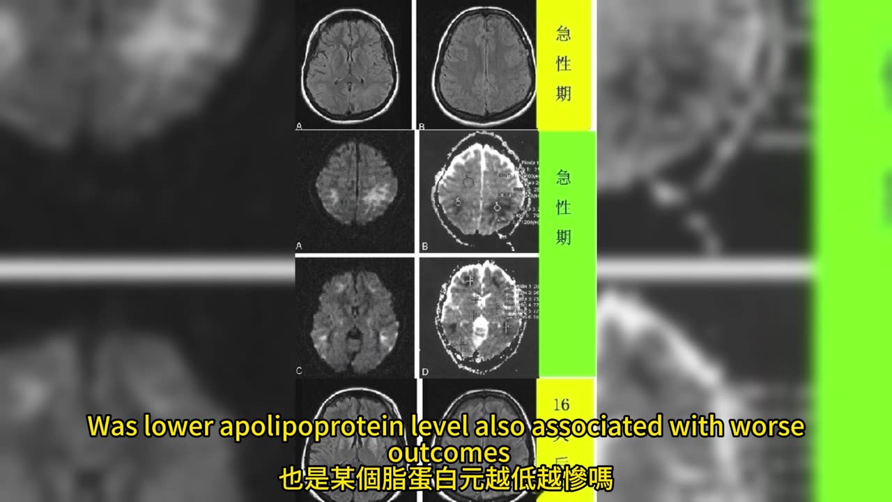 血液關鍵因子 「脂蛋白元M」