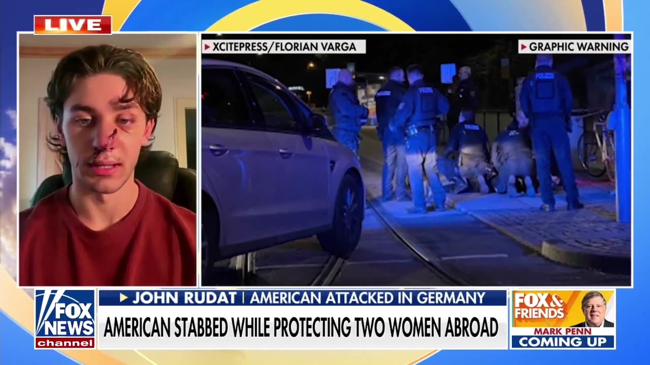 American Stabbed While Defending Women In Germany Speaks Out