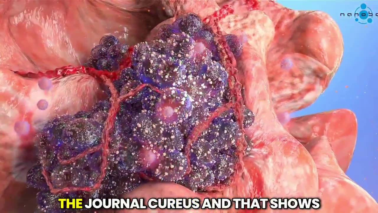 mRNA 'Vaccines' Cause Leukemia, Bombshell Study Finds