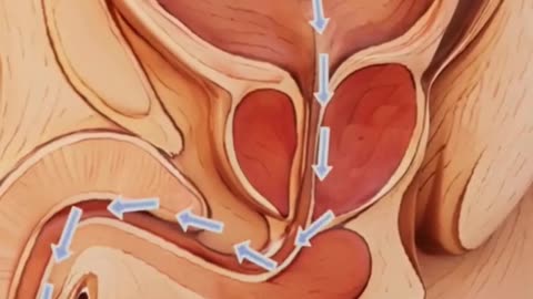 Comprehensive Urology Treatment in Madurai at Sandheep Hospital