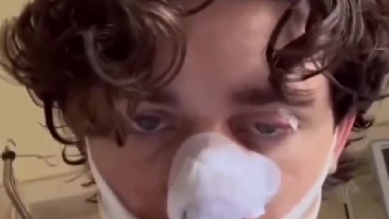 American Model Slashed in Face Protecting Women in Germany