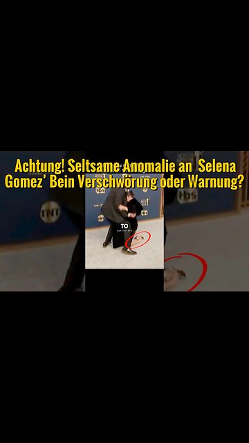 Beobachte ihr Bein genau: Was Selena Gomez uns verheimlicht