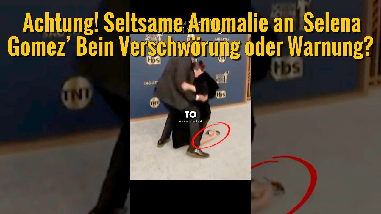 Beobachte ihr Bein genau: Was Selena Gomez uns verheimlicht