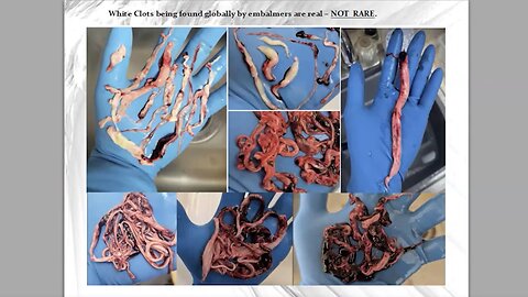 Clot Shot Science with Thomas Haviland and Greg Harrison