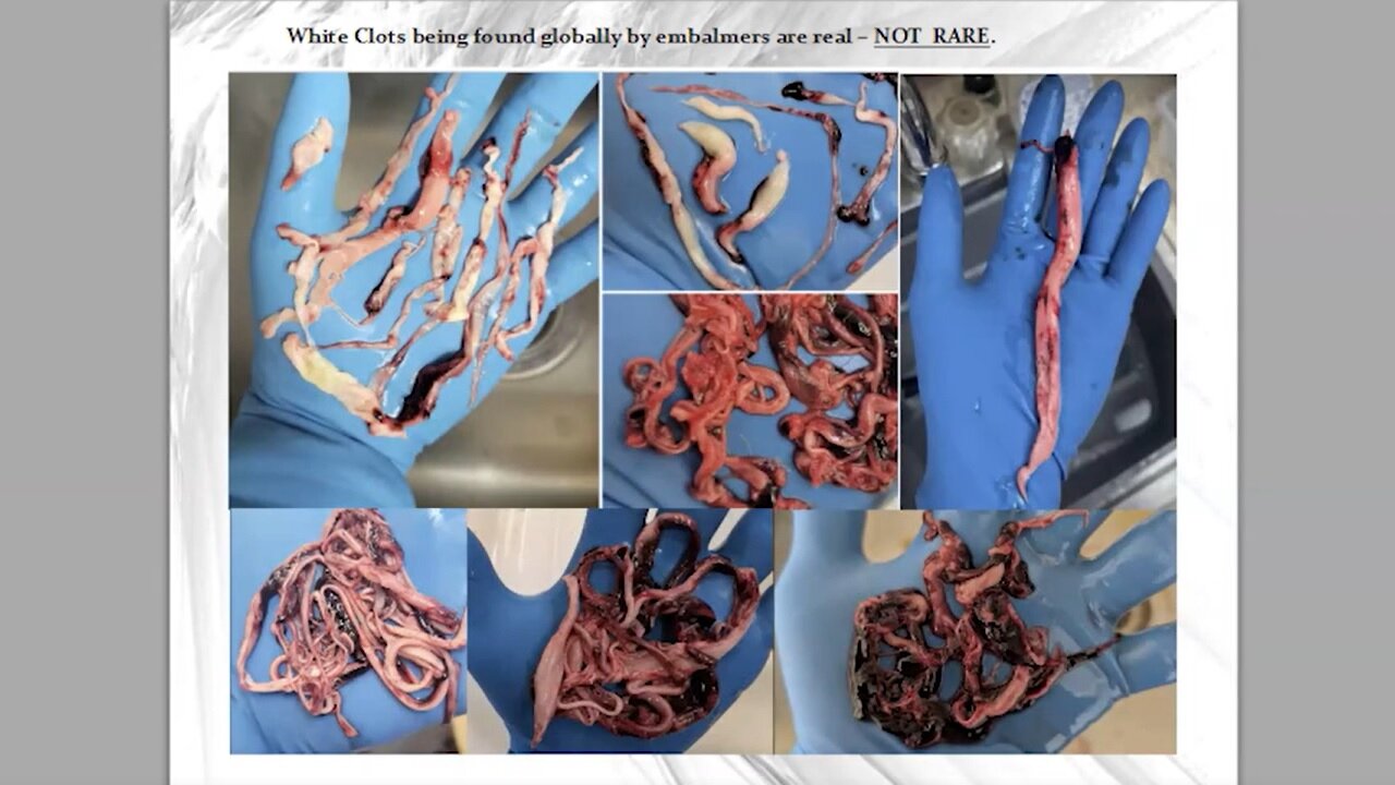 Clot Shot Science with Thomas Haviland and Greg Harrison