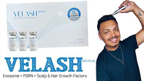 Join Me As I Micro-Needle VELASH EXO PLUS For Hair Growth & Scalp Rejuvenation