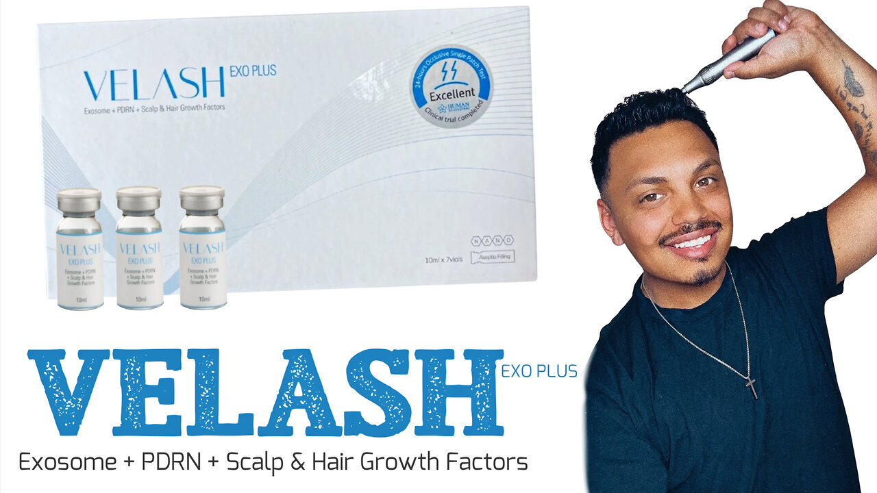 Join Me As I Micro-Needle VELASH EXO PLUS For Hair Growth & Scalp Rejuvenation