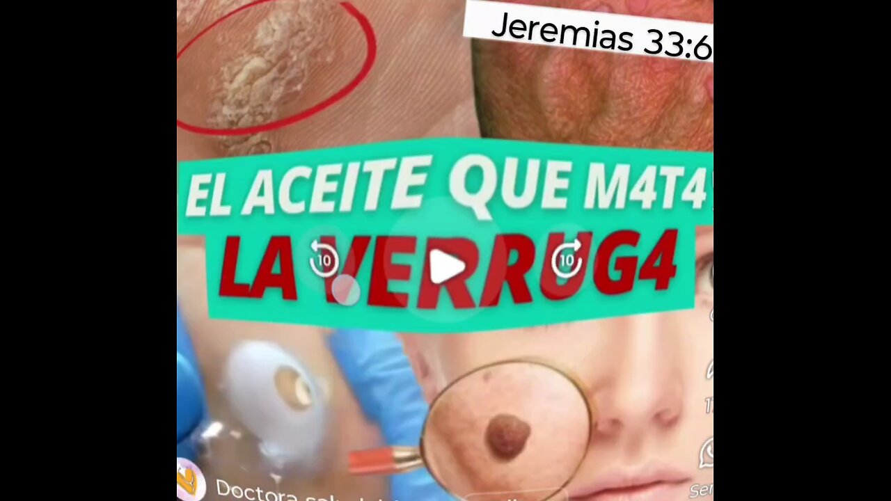 #medicina #cura #Fios