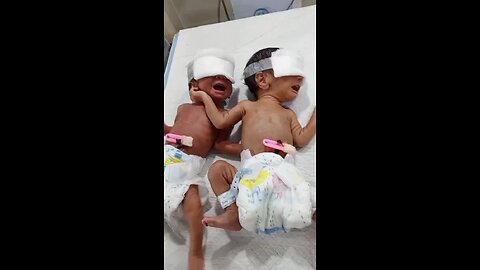 cute twins premature