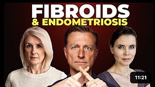 80% of Women Develop Fibroids—Here's Why!