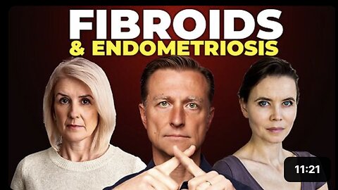 80% of Women Develop Fibroids—Here's Why!