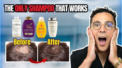 Are “miracle shampoos” for hair loss real — or just marketing?