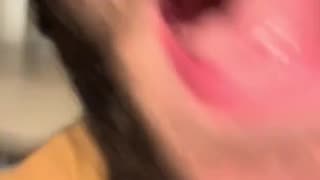 😂💣 It BURNS So Badly! | FunFM