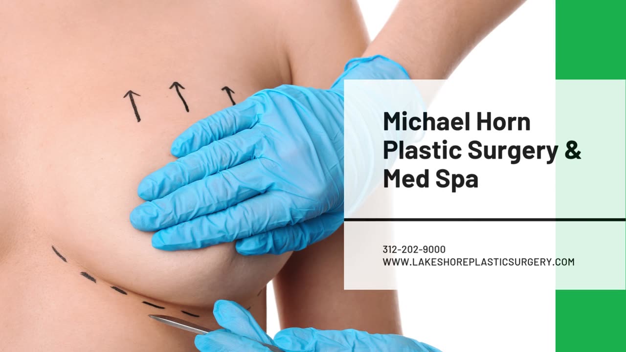 Breast Augmentation in Chicago, IL
