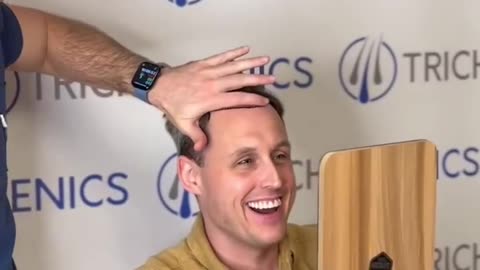 From Surgery to Stunning Results: A Real Hair Transplant Journey