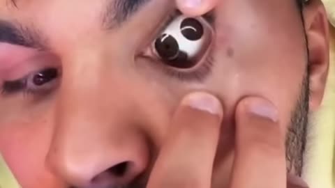 MY EYEBALL POPPED OUT