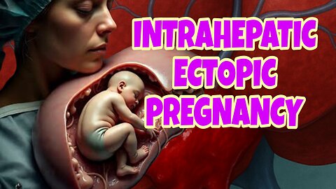 "Rare Intrahepatic Pregnancy: Fetus Found Growing Inside Woman's Liver"