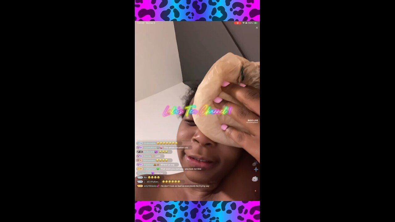 - 21 BB ; THE MORNING AFTER GETTING BEAT UP !