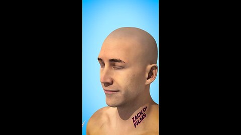 What Is A Lobotomy? #trending