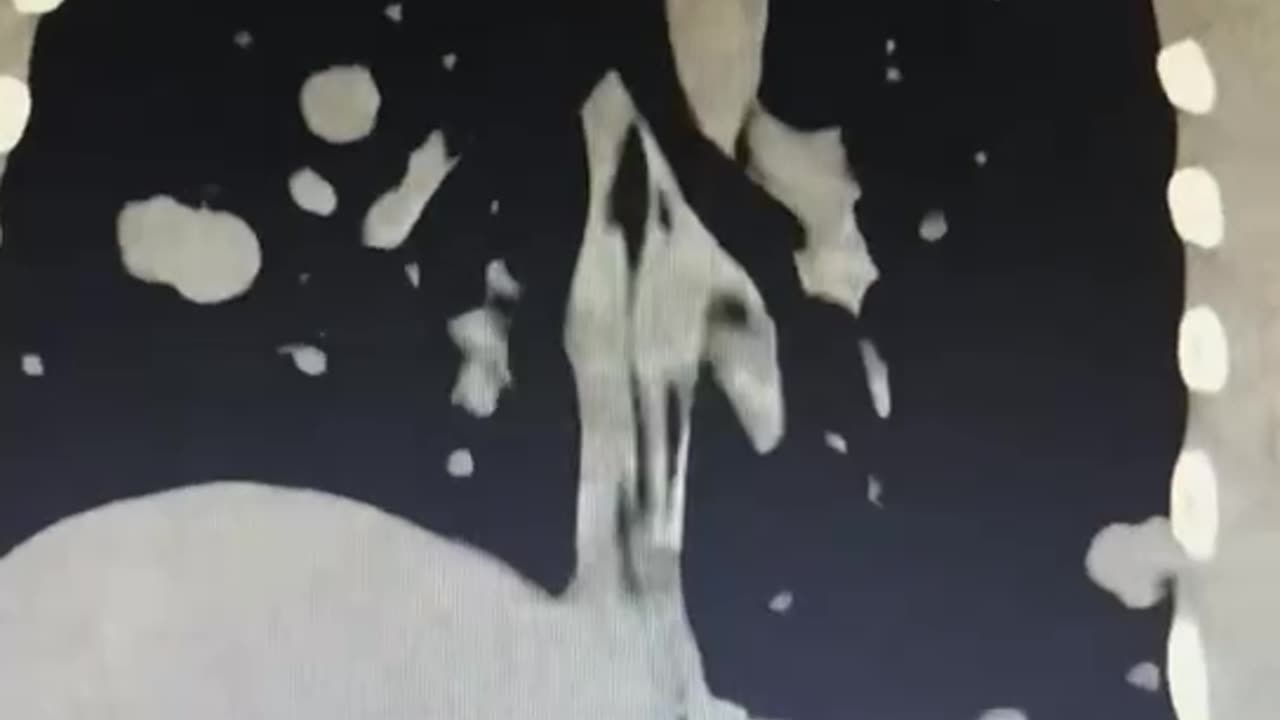 giovane di 21 anni con un turbocancro