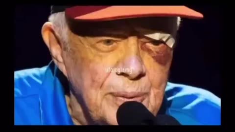 The Truth Behind Celebrity Black Eyes