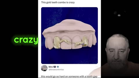 New Teeth Caps To Watch For