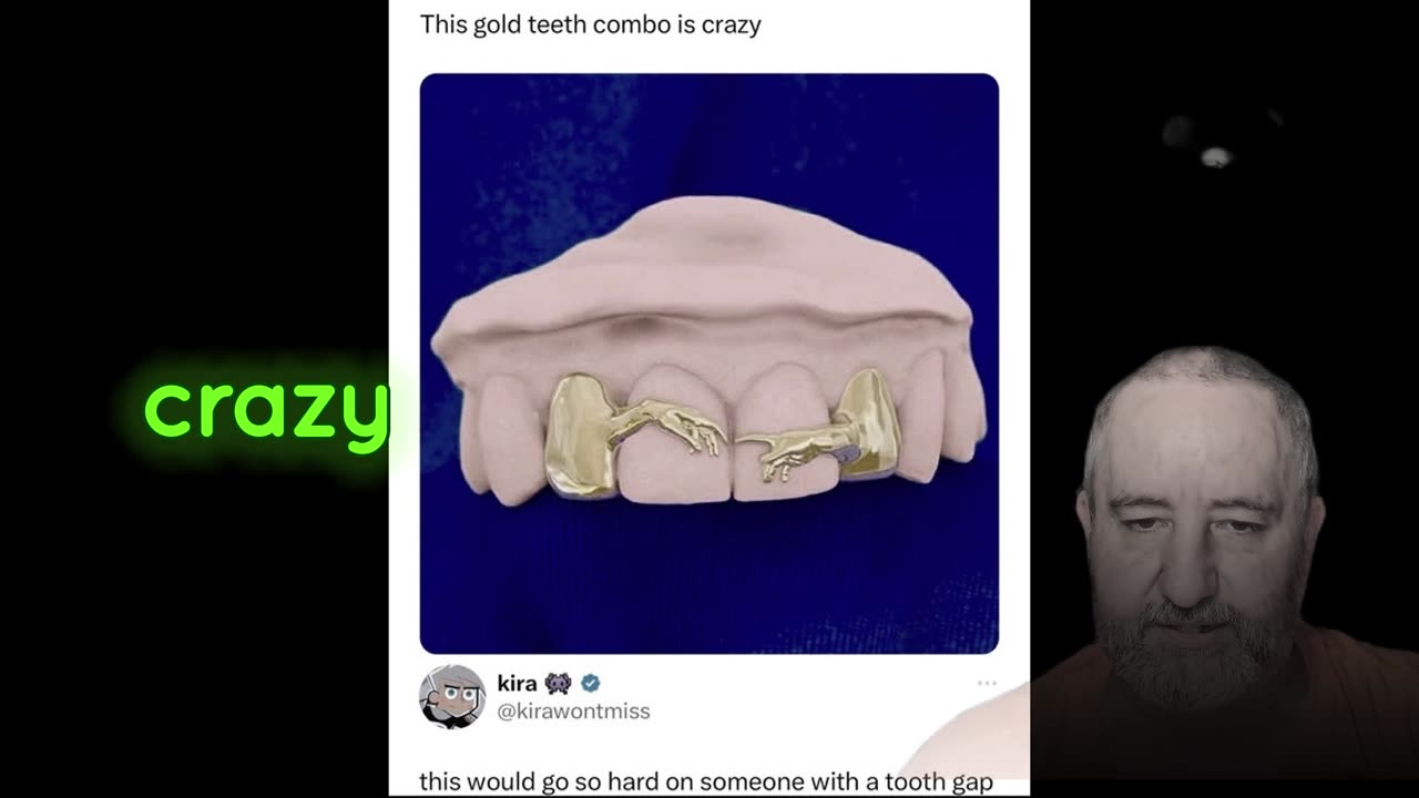 New Teeth Caps To Watch For