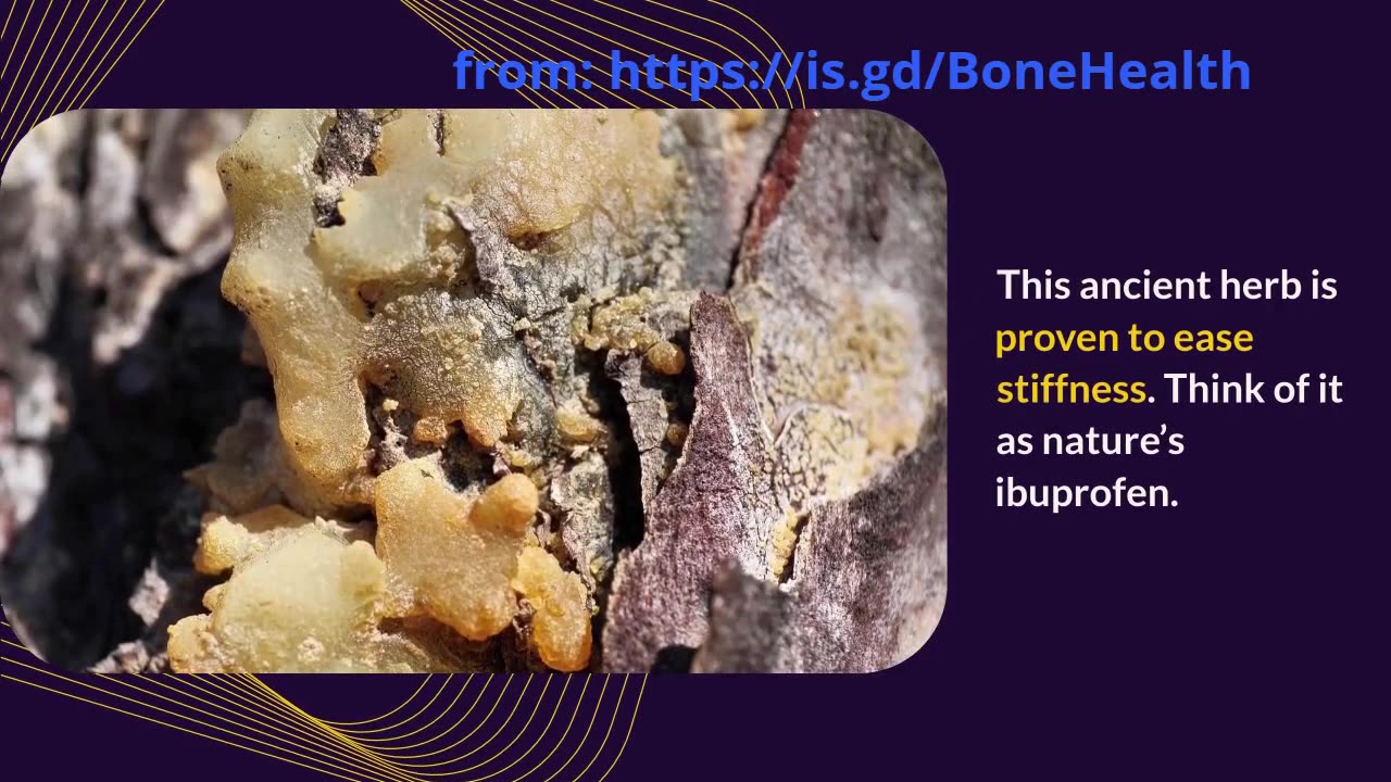 Natural Remedies for Arthritis Pain and Stiffness That Actually Work!