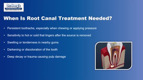 Understanding Root Canal Treatment: A Quick Guide