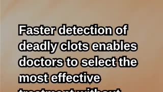 AI Is Revolutionizing Stroke Care in the NHS