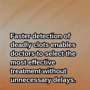 AI Is Revolutionizing Stroke Care in the NHS