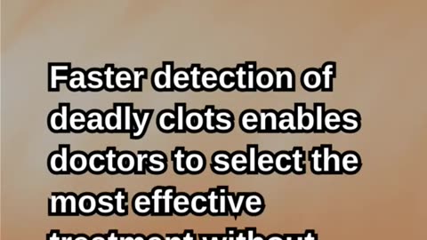 AI Is Revolutionizing Stroke Care in the NHS