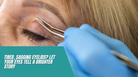 Blepharoplasty Miami