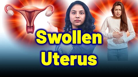 What is Swollen Uterus, Scraping, Cleaning Surgery for Enlarged Uterus,Bulky Uterus? Treatment & Cure