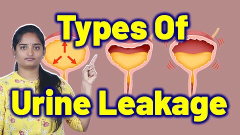 Types Of Urine Leakage, Overflow Incontinence | Leaking urine Homeopathy Medicine and Cure Surgery