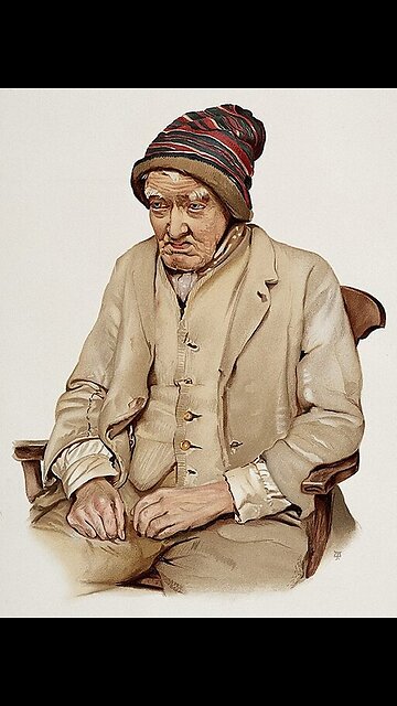 Nearly every single dementia case we have ever seen was on a statin drug.⁠