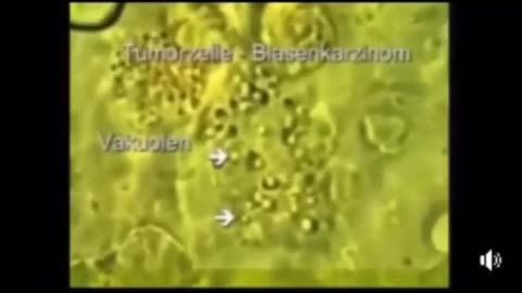 Ivermectin to cure Cancer??