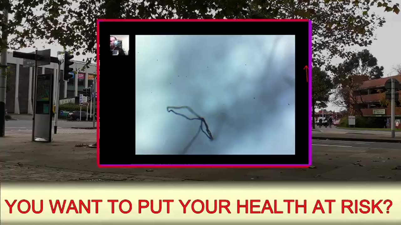 Update: Microscope with the N-Werms