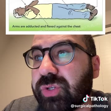Tiktok Doctor on CK Injury/Death: Same Points as Paramount/Martenson & the Others but Calls Jugular