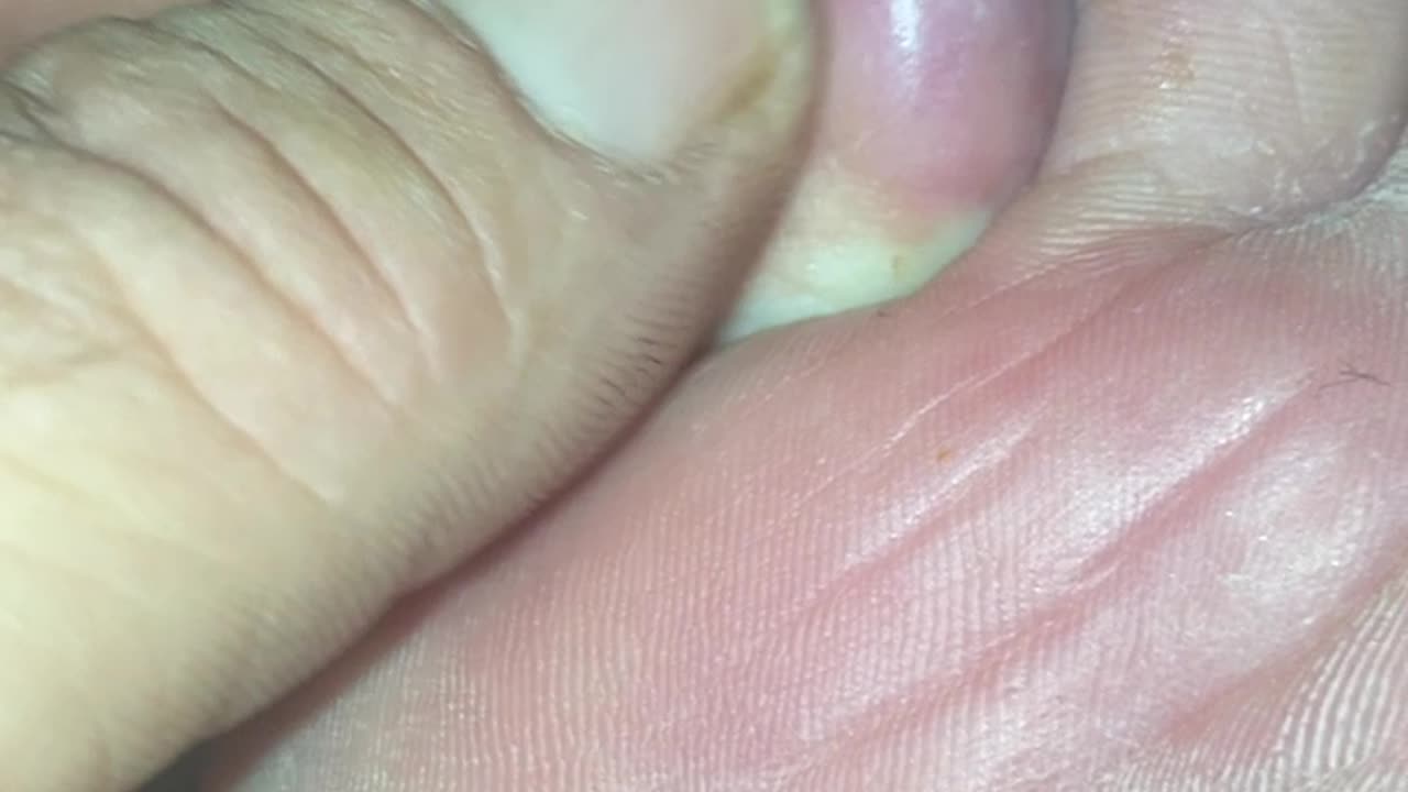 Looking pretty good from what it was