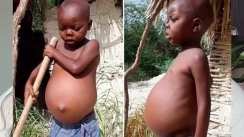 😨🧠 The Shocking Effects of Starvation on Your Brain! | FunFM