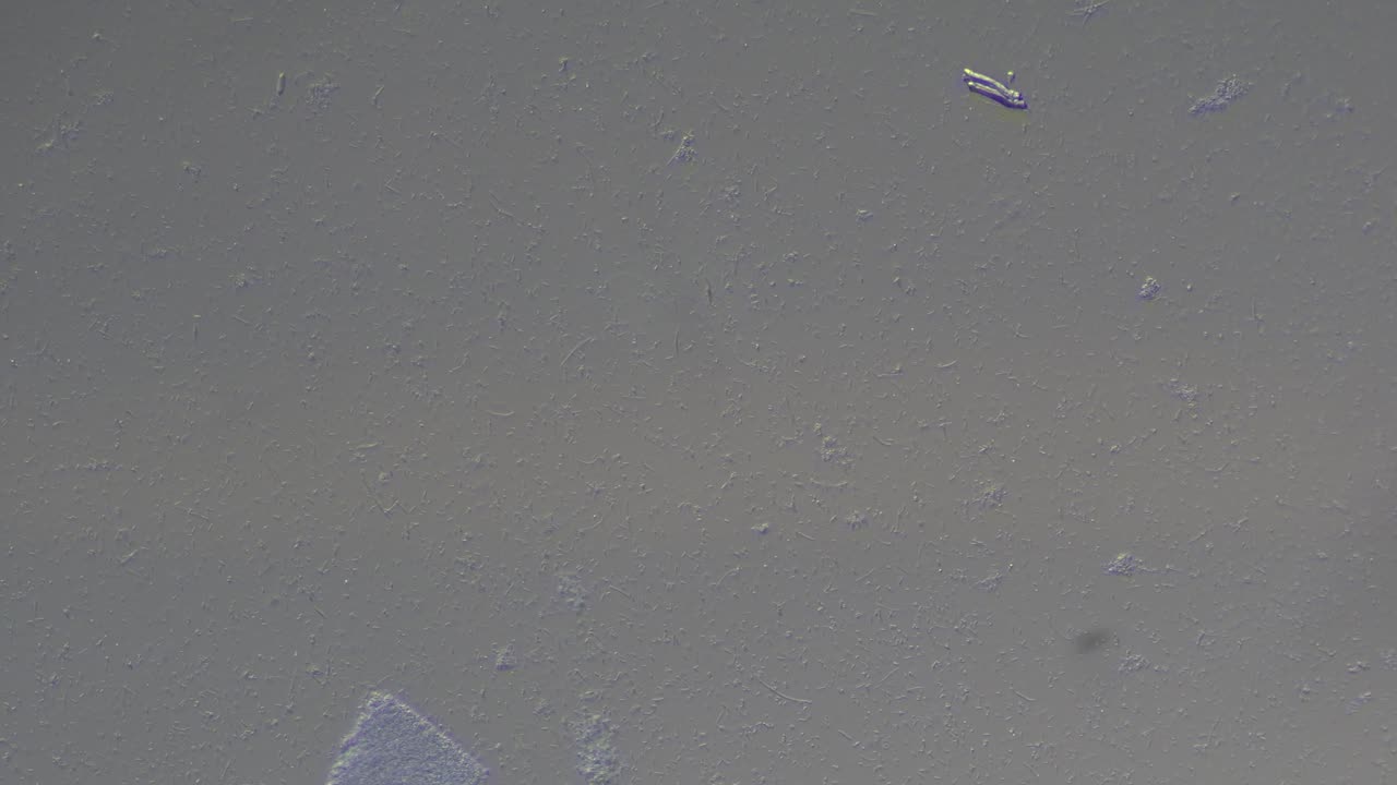 Ditch Water Under the Microscope